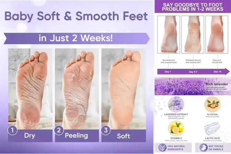 Detailed view of Best Foot Peeling Masks: Achieve Baby Soft Feet Effortlessly