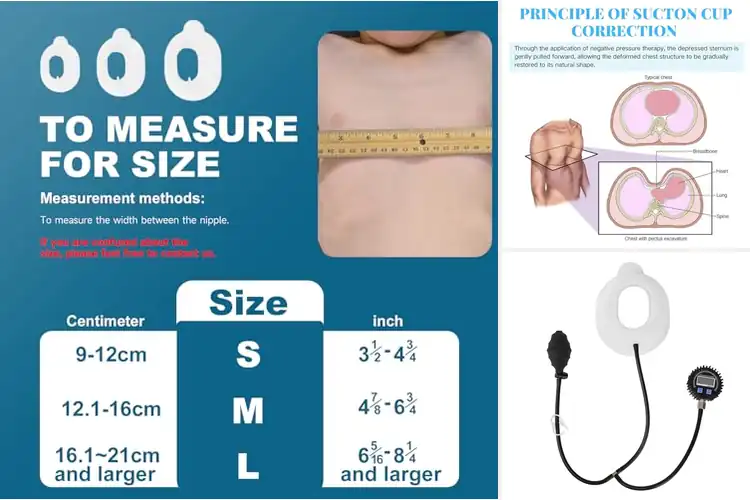 Detailed view of Best Pectus Excavatum Orthosis Braces